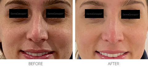 Appearance of Uneven Skin Tone, minor wrinkles